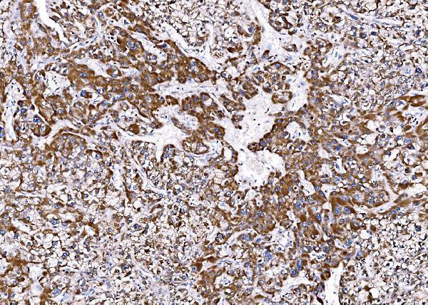a04561 1 bckdha primary antibodies ihc testing 5
