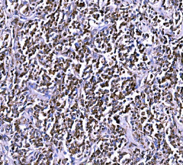 a04561 1 bckdha primary antibodies ihc testing 6