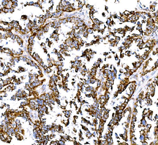a04561 1 bckdha primary antibodies ihc testing 7