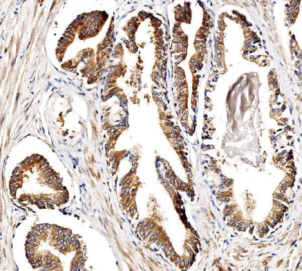 a04561 1 bckdha primary antibodies ihc testing 8