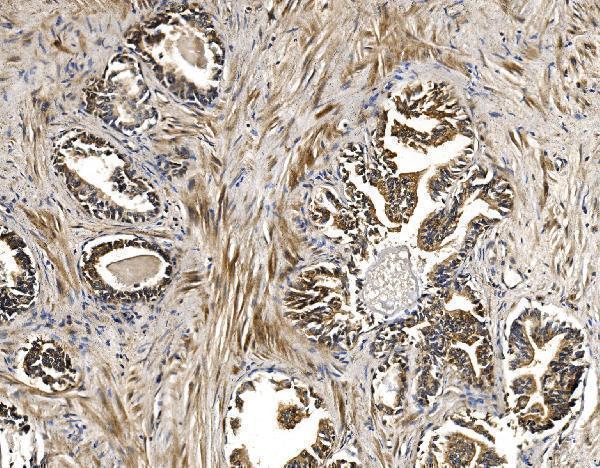 a04561 1 bckdha primary antibodies ihc testing 9
