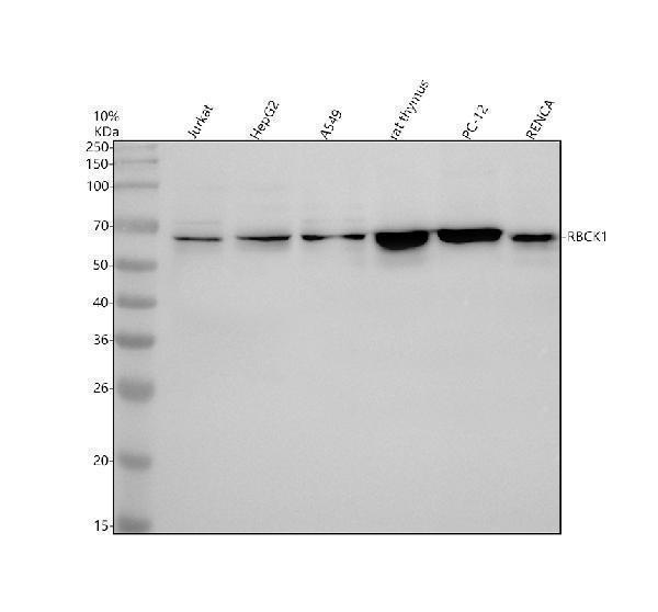 Western blot analysis of RBCK1 using anti-RBCK1 antibody (A04562-1)