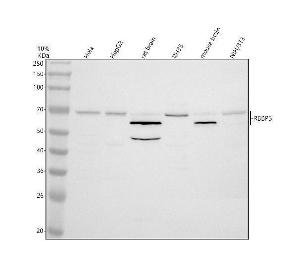 Western blot analysis of RBBP5 using anti-RBBP5 antibody (A04563-1)