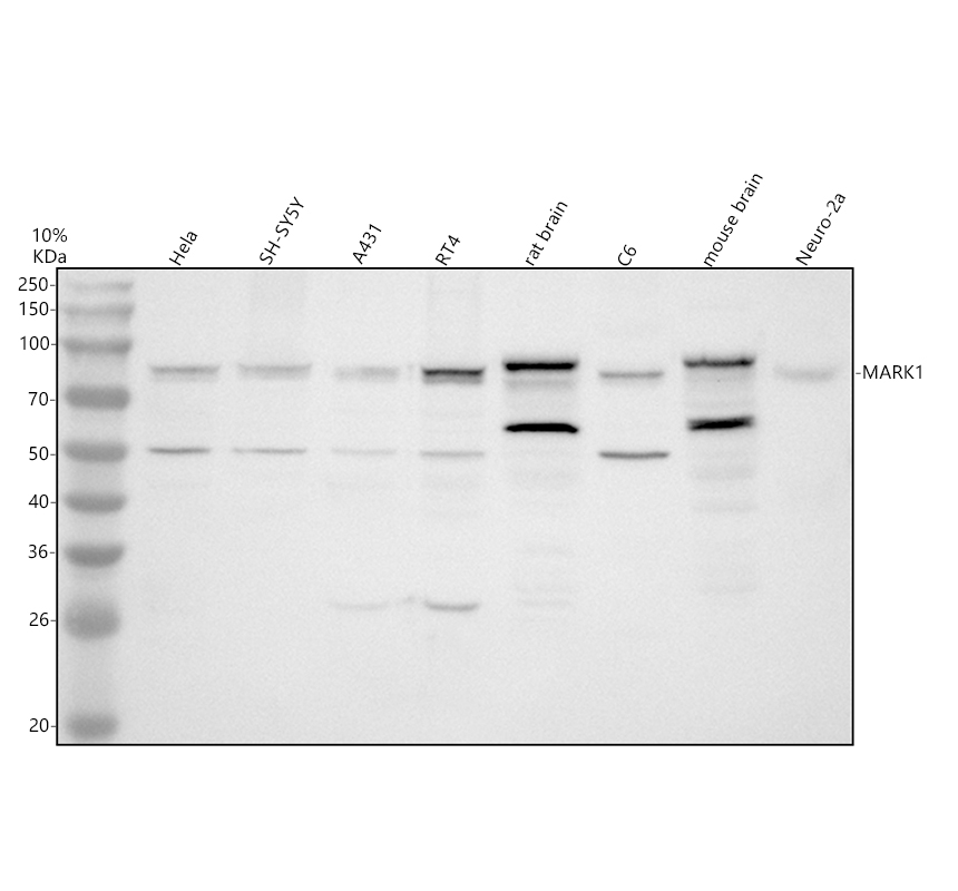 Western blot analysis of MARK1 using anti-MARK1 antibody (A04564-2)