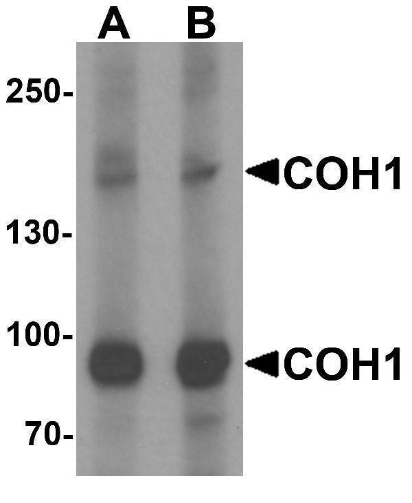 Western blot analysis of COH1 in SK-N-SH cell lysate with COH1 antibody at (A) 1 and (B) 2 μg/mL