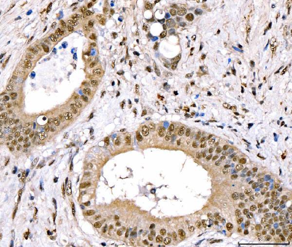  IHC analysis of CRTC3 using anti-CRTC3 antibody (A04568-2)