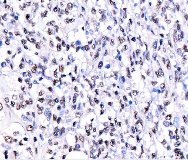  IHC analysis of CRTC3 using anti-CRTC3 antibody (A04568-2)