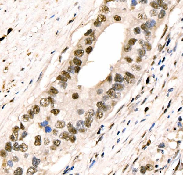a04568 2 crtc3 primary antibodies ihc testing 5