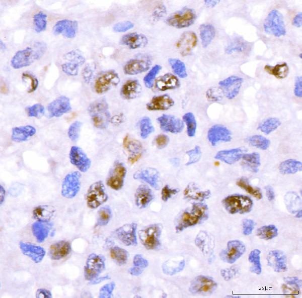a04568 2 crtc3 primary antibodies ihc testing 6