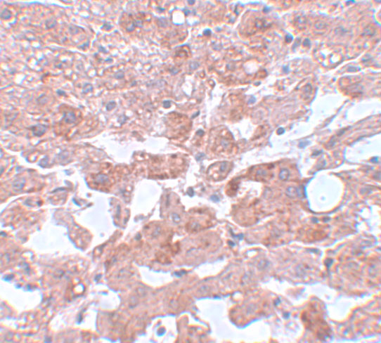 Immunohistochemistry of APC6 in human liver tissue with APC6 antibody at 5 μg/mL