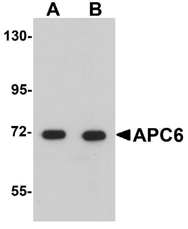 Western blot analysis of APC6 in human liver tissue lysate with APC6 antibody at (A) 1 and (B) 2 μg/mL