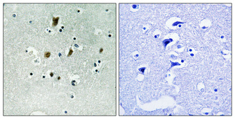 Immunohistochemical analysis of paraffin-embedded Human brain