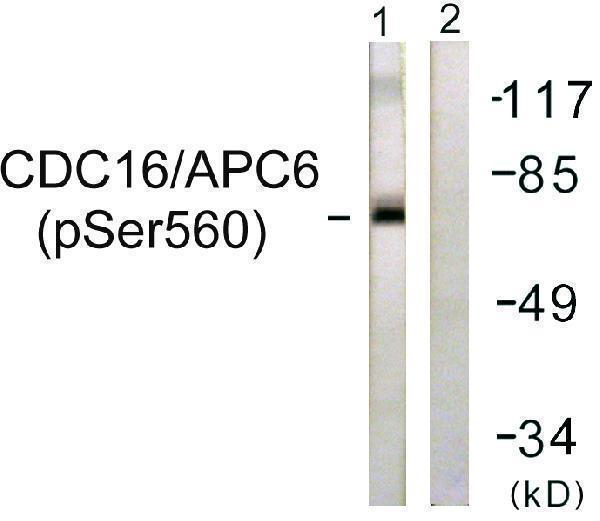 Western blot analysis of lysates from HUVEC cells, using CDC16/APC6 (Phospho-Ser560) Antibody
