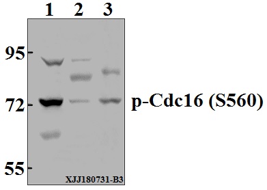 Western blot (WB) analysis of p-Cdc16 (S560) pAb at 1:500 dilution
Lane1:A375 whole cell lysate(40µg)
Lane2:U-87MG whole cell lysate(40µg)
Lane3:C6 whole cell lysate(40µg)
