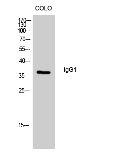 Western Blot analysis of colo cells using IgG1 Polyclonal Antibody diluted at 1:500