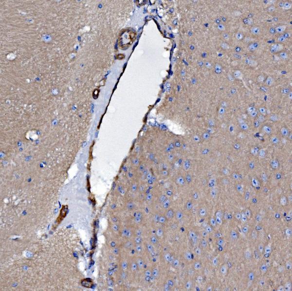 a04576 1 ehd3 primary antibodies ihc testing 10