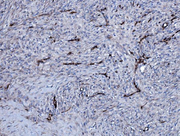 a04576 1 ehd3 primary antibodies ihc testing 3