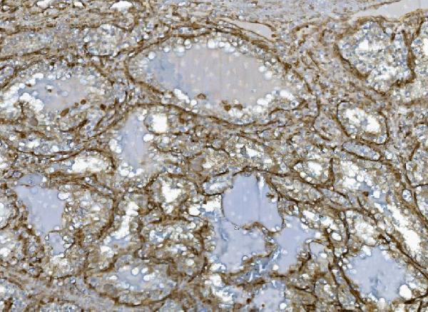 a04576 1 ehd3 primary antibodies ihc testing 5