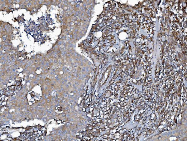 a04576 1 ehd3 primary antibodies ihc testing 6