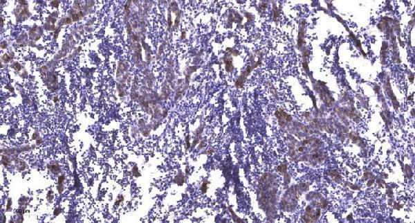 a04578s759 cald1 primary antibodies ihc testing 1