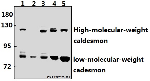 Western blot (WB) analysis of Caldesmon (S783) polyclonal antibody at 1:500 dilution
Lane1:MCF-7 whole cell lysate(20ug)
Lane2:Hela whole cell lysate(40ug)
Lane3:A549 whole cell lysate(40ug)
Lane4:PC12 whole cell lysate(40ug)
Lane5:MEF whole cell lysate(40ug)