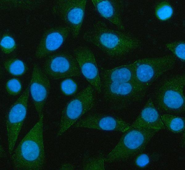 a04579 2 pcmt1 primary antibodies if testing 8