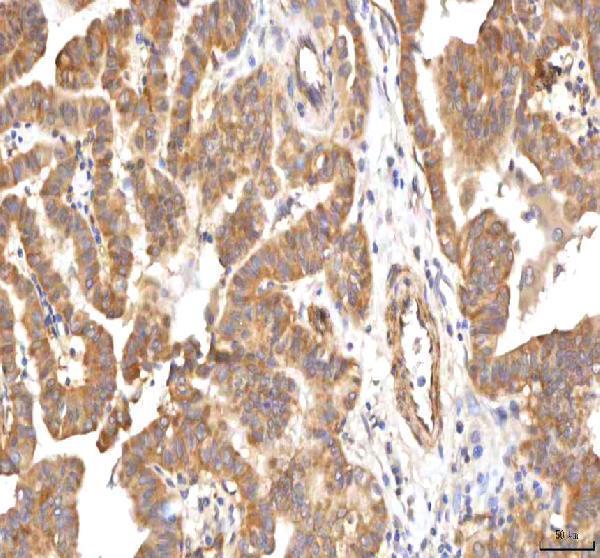  IHC analysis of PCMT1 using anti-PCMT1 antibody (A04579-2)
