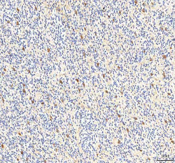 a04579 2 pcmt1 primary antibodies ihc testing 4