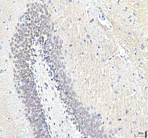 a04579 2 pcmt1 primary antibodies ihc testing 5