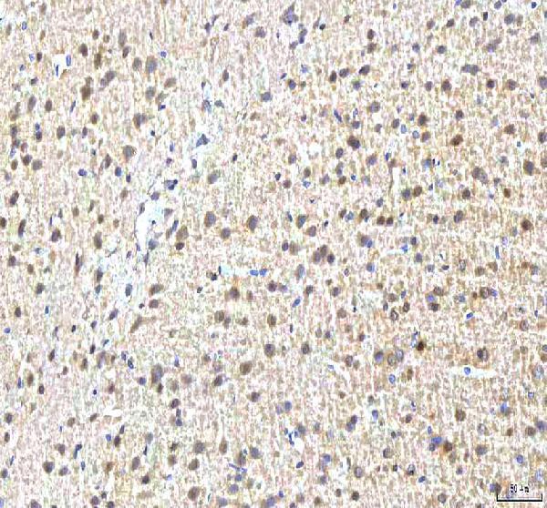 a04579 2 pcmt1 primary antibodies ihc testing 6