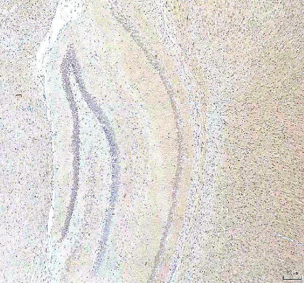 a04579 2 pcmt1 primary antibodies ihc testing 7