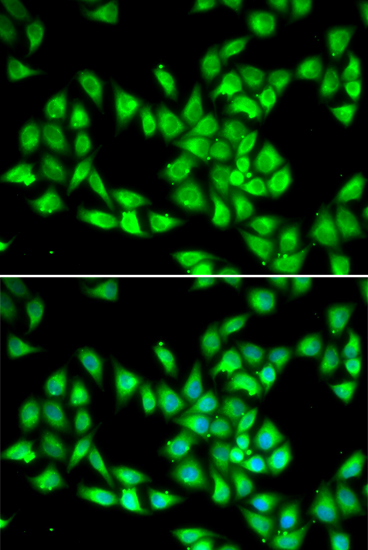 Immunofluorescence analysis of HeLa cells using PCMT1 antibody 