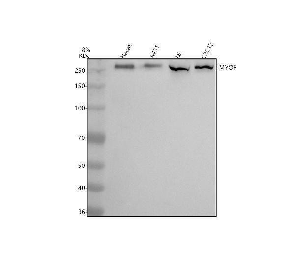 Western blot analysis of MYOF using anti-MYOF antibody (A04580-1)