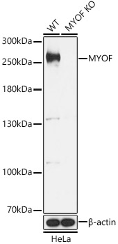 a04580 myof primary antiboties wb testing 1