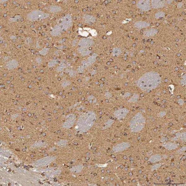 a04582 sec31a primary antibodies ihc testing 11