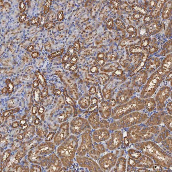 a04582 sec31a primary antibodies ihc testing 13