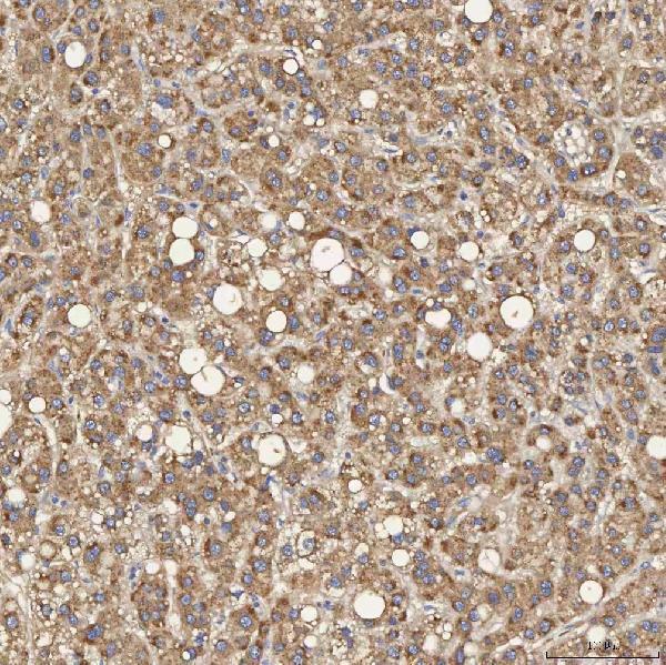 a04582 sec31a primary antibodies ihc testing 2