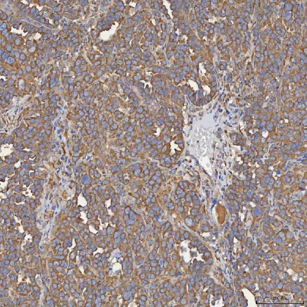 a04582 sec31a primary antibodies ihc testing 3