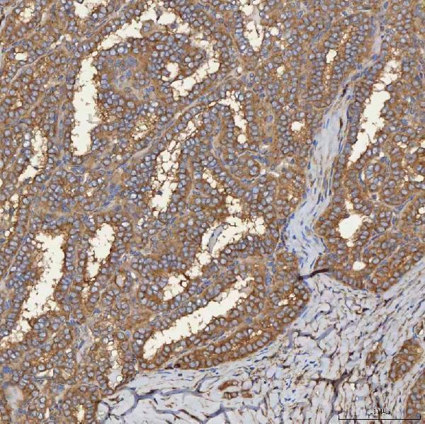 a04582 sec31a primary antibodies ihc testing 7