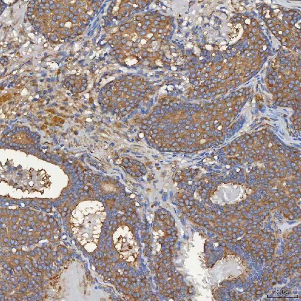 a04582 sec31a primary antibodies ihc testing 8