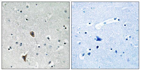 a04583 1 oxr1 primary antibodies ihc testing 1