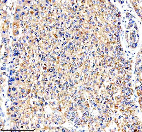  IHC analysis of COX17 using anti-COX17 antibody (A04584-1)