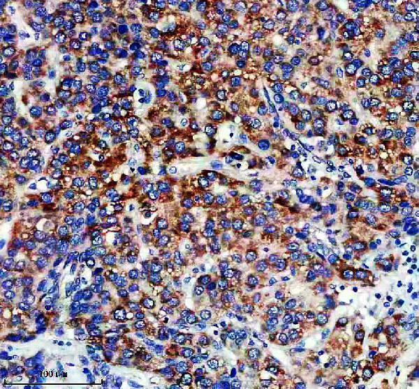 a04584 1 cox17 primary antibodies ihc testing 2_1