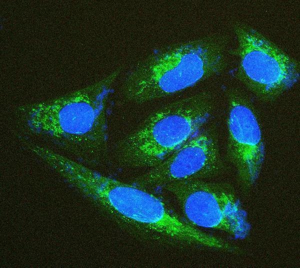 a04586 1 txn2 primary antibodies if testing 11