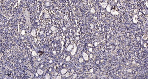 a04587 1 dcp1a primary antibodies ihc testing 1