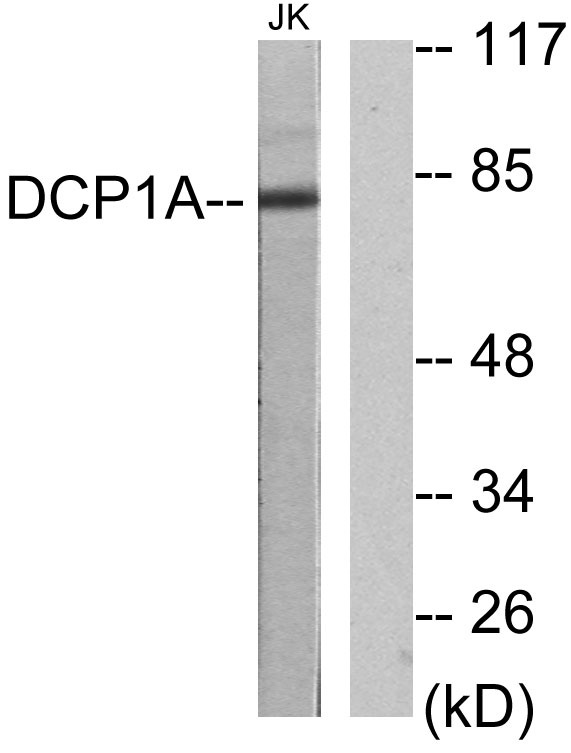 a04587 1 dcp1a primary antibodies wb testing 2
