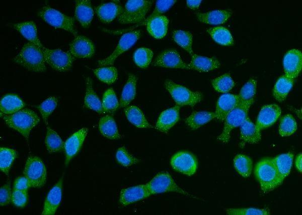  IF analysis of DCP1A using anti-DCP1A antibody (A04587-2)