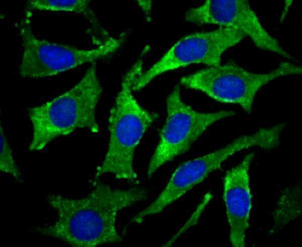 ICC staining Dcp1a in SH-SY-5Y cells (green)