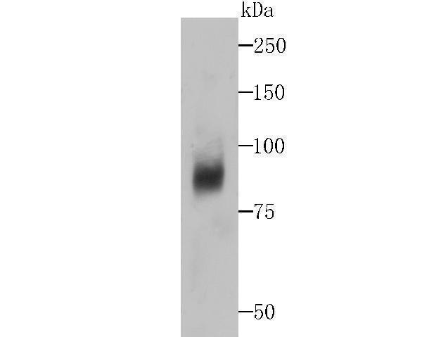 Western blot analysis of Dcp1a on human liver tissue lysates using anti-Dcp1a antibody at 1/500 dilution