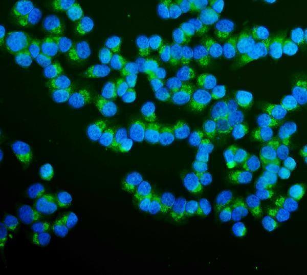 a04589 1 rab1b primary antibodies if testing 7